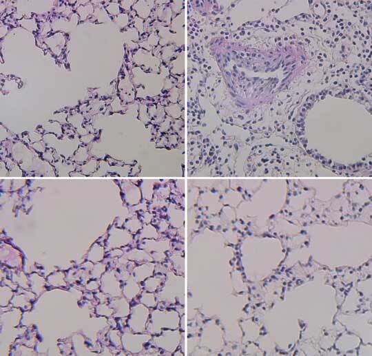resp-aid-histology-lincial-trials-information.jpg