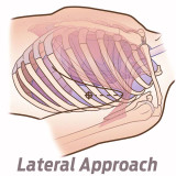NAR SPEAR, graphic