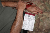SOF MIST™ Casualty Treatment Card, in use