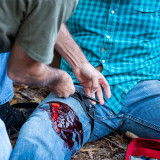 SOF Tourniquet - Generation 5 in use on civilian leg