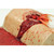 Simulated Hemostatic Gauze, in use