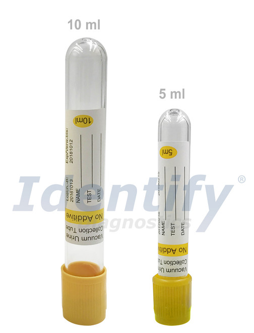 Vacuum Urine Collection Tubes - 10ml or 5ml Yellow