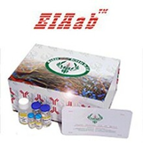 Mouse Vipr1/Vasoactive intestinal polypeptide receptor 1 ELISA Kit