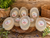 Natural Acne Bar Soap Bundle