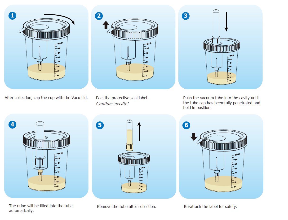 Vacuum Cup Instructions