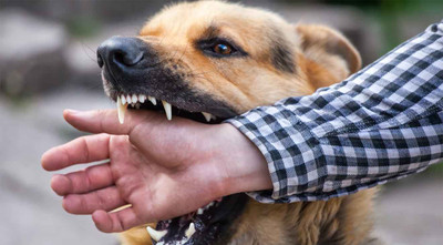 How to Tips to Help Prevent Dog Bites