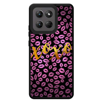 Xoxo Gliter 2 Motorola Moto G Stylus 2026 Case