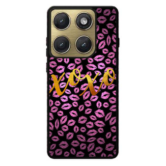 Xoxo Gliter 2 Motorola Edge 2026 Case