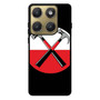 Pink Floyd hammer logo Motorola Edge 2026 Case