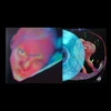 Indie Store Blue Marble Vinyl