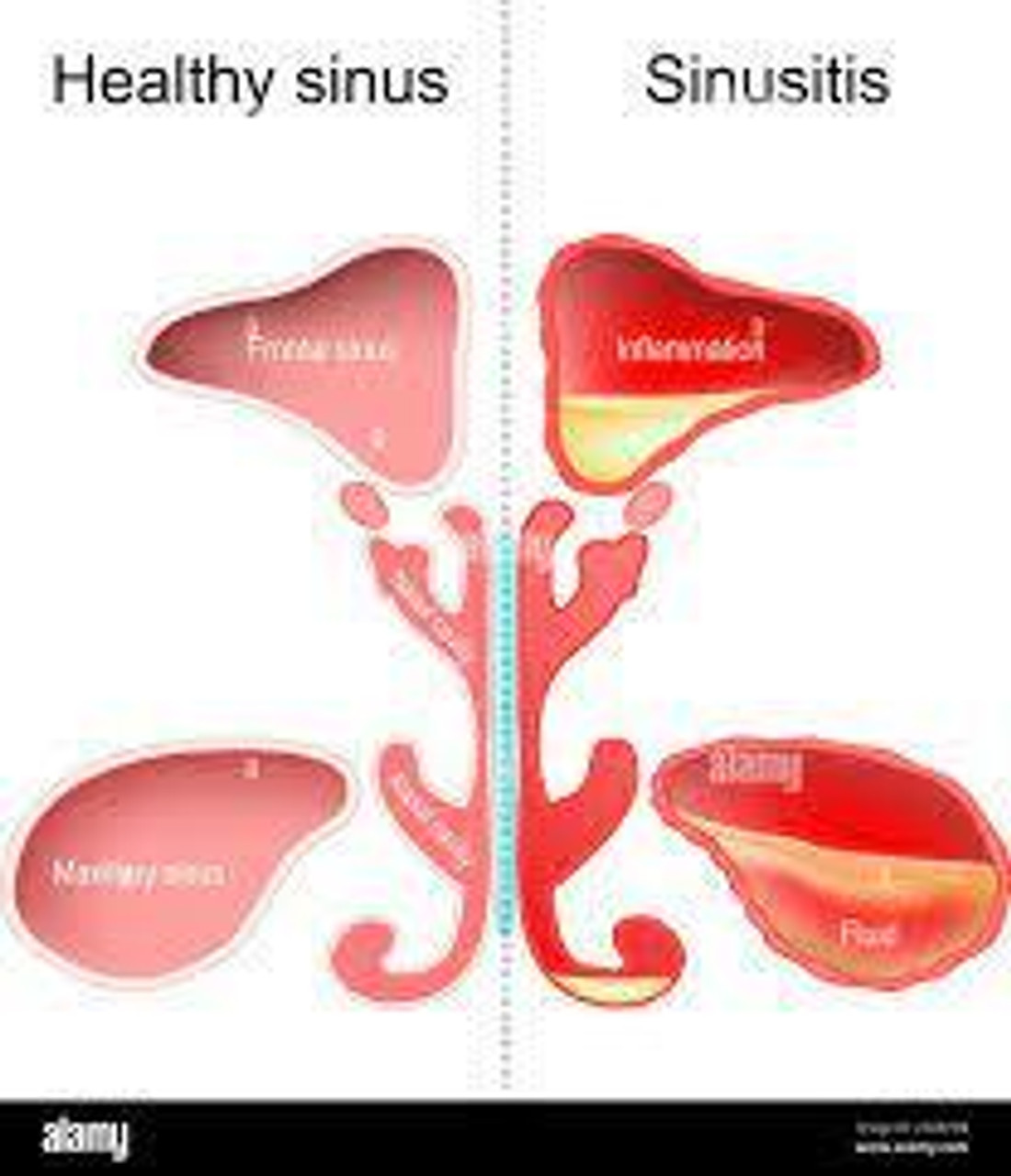 Sinus & Nasal Health & Support