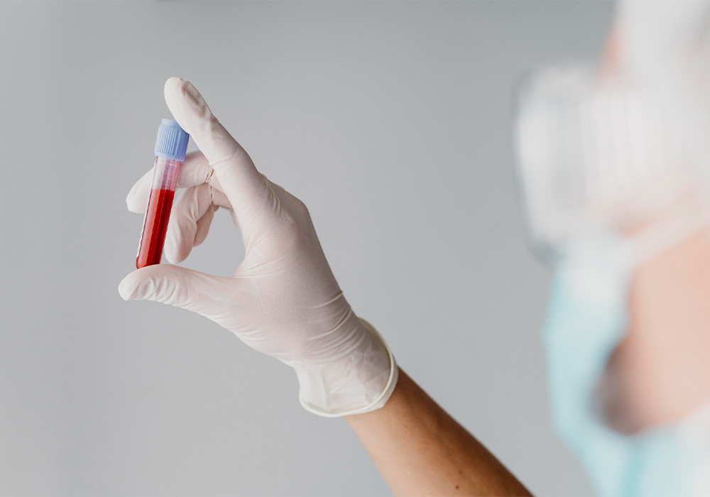 Analíticas en Farmacia Areses, en Madrid