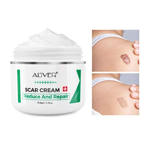 Scar Removal Cream for Old Scars  Stretch Mark Relief and Burns  Natural Skin Repair  Effective in Fading Acne Scars  Acne Spots Treatment- Scar Removal Cream for Old Scars  Stretch Mark Relief and Burns  Natural Skin Repair  Effective in Fading Acne Scars  Acne Spots Treatment-