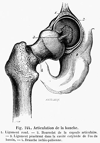 Human Hip Joint Nline Engraving French 19Th Century Poster Print by -18 x 24-