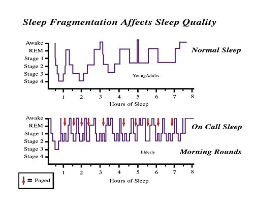 Posterazzi Poster Print Collection Fragmentation Affects Sleep Quality Graph Gwen ShockeyScience Source 24 x 18 Multicolored