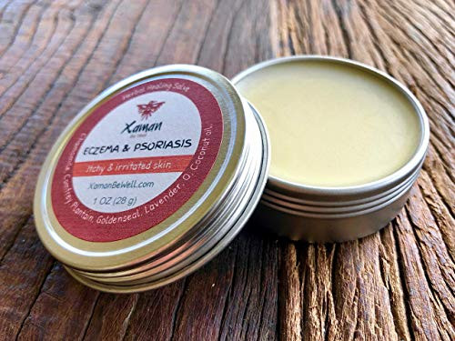 Eczema  and  Psoriasis organic herbal healing salve  natural moisturizer  skin nourishing balm for sensitized skin