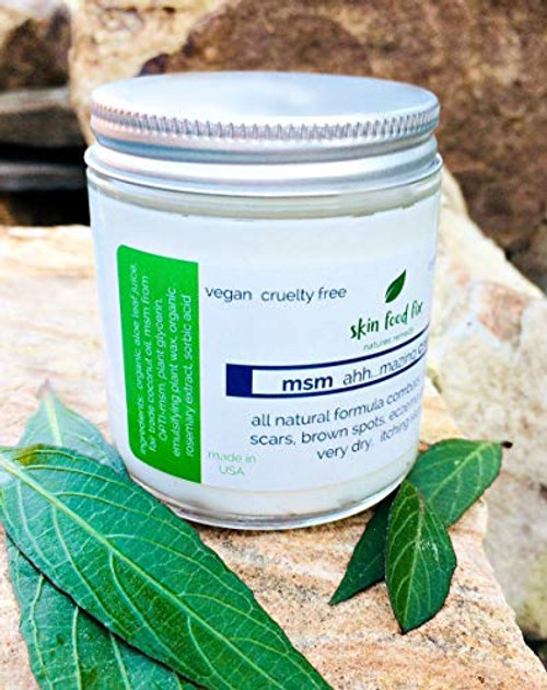 Rosacea skin Care_ Eczema Psoriasis_ Acne Scars_ OptiMSM Rosacea skin Care_ Eczema Psoriasis_ Acne Scars_ OptiMSM