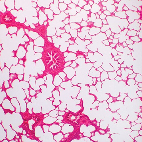 Human Lung Slide_ 7 m_ H and E