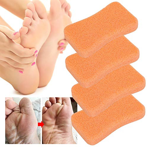 Foot File Callus Remover 4pcs Callus Exfoliate Stone Feet Care Pumice Stone Feet Hard Skin Remove Pedicure Scrubber Foot Care Pedicure Tool for Dead Hard Cracked Dry Skin-Orange- Foot File Callus Remover 4pcs Callus Exfoliate Stone Feet Care Pumice Stone Feet Hard Skin Remove Pedicure Scrubber Foot Care Pedicure Tool for Dead Hard Cracked Dry Skin-Orange-