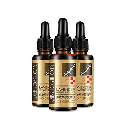 Benkeg Lavender Repair Essence - Lavender Repair Essence Oil Dilute Remove Cream Acne Burn Scar Stretch Marks Removal Paste Skin Care for Pregnant Postpartum Benkeg Lavender Repair Essence - Lavender Repair Essence Oil Dilute Remove Cream Acne Burn Scar Stretch Marks Removal Paste Skin Care for Pregnant Postpartum