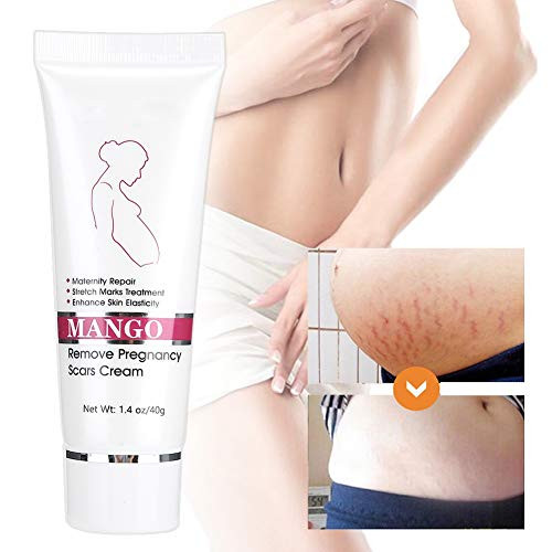 Stretch Mark Cream  Scar Cream Removal Cream Scars Essence Stretch Mark Repair Cream Stretch Scars Remove Acne Cream Stretch Mark Treatment Maternity Repair Stretch Mark Cream  Scar Cream Removal Cream Scars Essence Stretch Mark Repair Cream Stretch Scars Remove Acne Cream Stretch Mark Treatment Maternity Repair