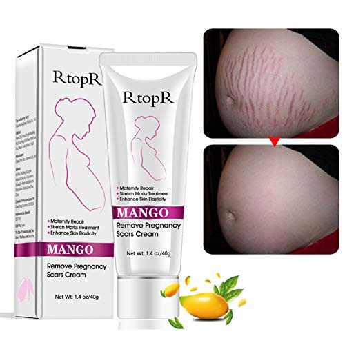 3pcs Scars Removal Cream  Mango Remove Pregnancy Scars Cream Stretches Marks Treatment Maternity Repair Firming Skin