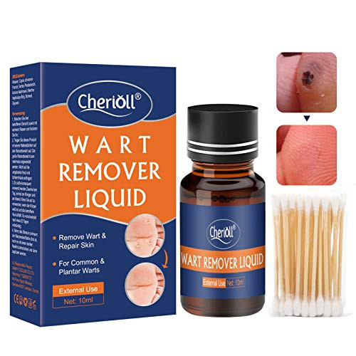 Wart Remover  Corn Remover  Removes Plantar  Eliminates Warts  and  Prevents wart Emergence  Relief Pain Removal Warts  penetrates and removes Warts and wart Remover