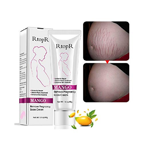 PIKAJIU 2PC Stretch Mark Removal Cream Repair Scars Stretch Marks Remove Pregnancy Scar Cream  A