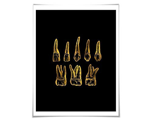 Human Teeth Gold Foil Print. Gold Silver Copper. 36 Colours 3 Sizes. Dentist Dental Office Tooth Wall Art. Anatomy Poster.