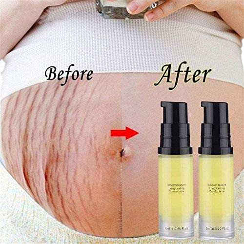 mkyulyp Silky Summer Smoothing Cream for Stretch Marks Postpartum Stretch Mark Belly Cream Postpartum Obesity Pregnancy Cream Repair Scar Slack Line Abdomen Stretch Marks -2pcs-