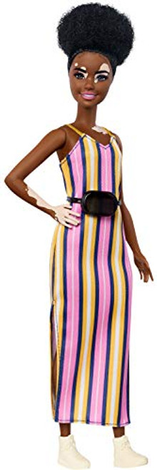 Barbie Fashionistas Doll 135 with Vitiligo and Curly Brunette Hair Wearing Striped Dress and Accessories for 3 to 8 Year Olds -Amazon Exclusive- Barbie Fashionistas Doll 135 with Vitiligo and Curly Brunette Hair Wearing Striped Dress and Accessories for 3 to 8 Year Olds -Amazon Exclusive-