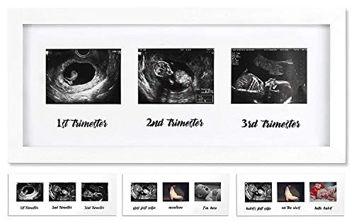 IHEIPYE Triple Sonogram Pregnancy Frame - Baby Ultrasound Picture Frame for Expecting Parents Baby Shower Frame Gender Reveal Party Baby Nursery Decor White