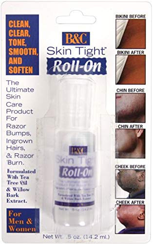 B and C Skin Tight Razor Bump Ointment 12Oz Extra -Pack of 3-