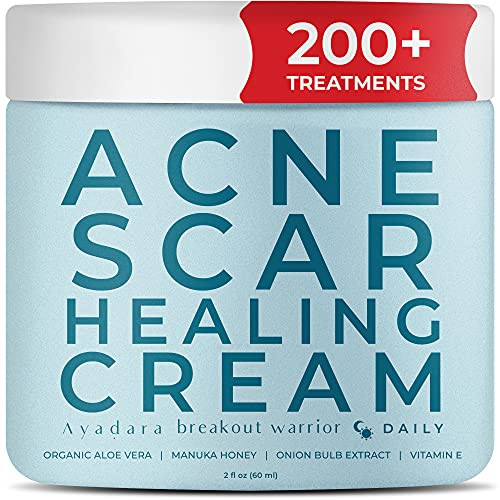 Ayadara Acne Scar Healing Cream | Vitamin E Cream for Zit, Milia,  and  Blemish Scarring | Aloe Vera Scar Removal Cream for Marks  and  Dark Spots | Post-Pimple Treatment for Teens  and  Adults | 200 plus Treatments