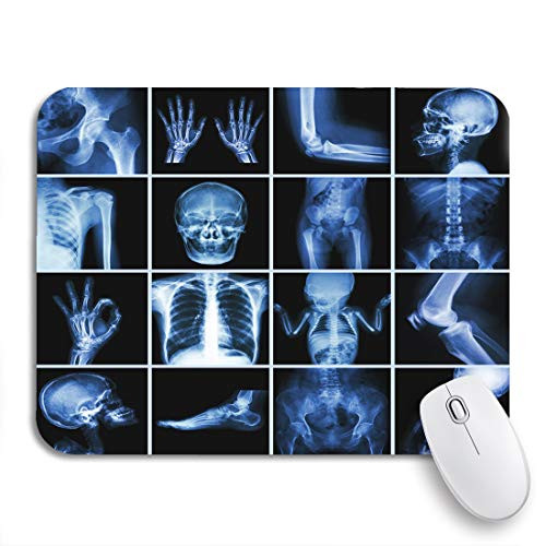 Adowyee Gaming Mouse Pad Ray Collection Multiple Part of Human Xray Bone Hospital 9.5"x7.9" Nonslip Rubber Backing Mousepad for Notebooks Computers Mouse Mats