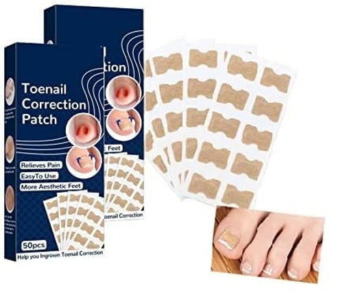 Toenail Correction Patch, 100PCS Ingrown Toenail Corrector Strips, Health Toenail Corrector Patch, Professional Toenail Treatment Tool Foot Care, Glue-Free Nail Corrector Patch