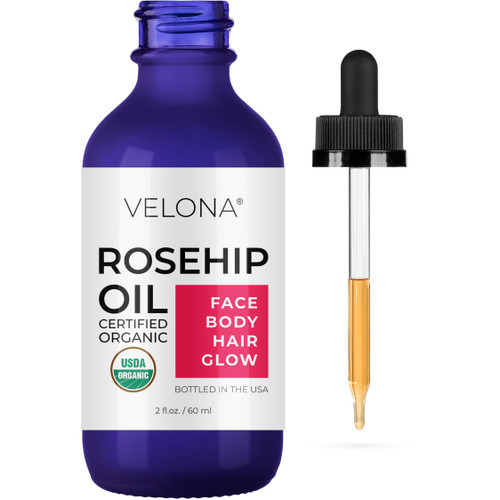 velona Rosehip Oil USDA Certified Organic - 2 oz | 100% Pure and Natural Carrier Oil| Unrefined, Cold Pressed, Hexane Free | Moisturizing Face, Hair, Body, Skin Care, Stretch Marks, Scars