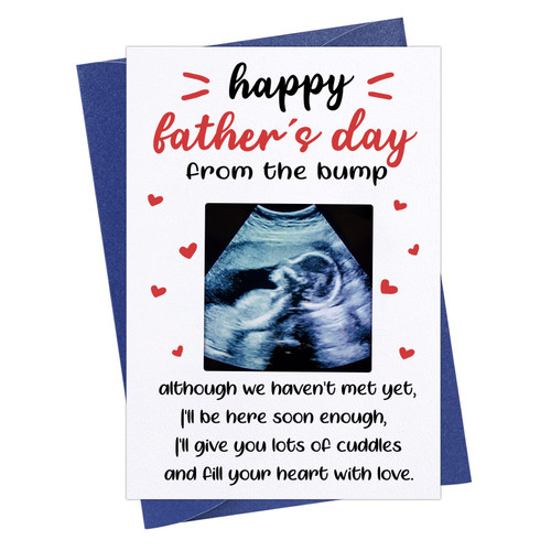 FaCraft Happy First Fathers Day Card for Dad 1st Fathers Day Card from Baby Daughter Son 1st Fathers Day with Photo Insert First Father's Day Card for First Time Dad New Dad Father to Be Daddy FaCraft Happy First Fathers Day Card for Dad 1st Fathers Day Card from Baby Daughter Son 1st Fathers Day with Photo Insert First Father's Day Card for First Time Dad New Dad Father to Be Daddy