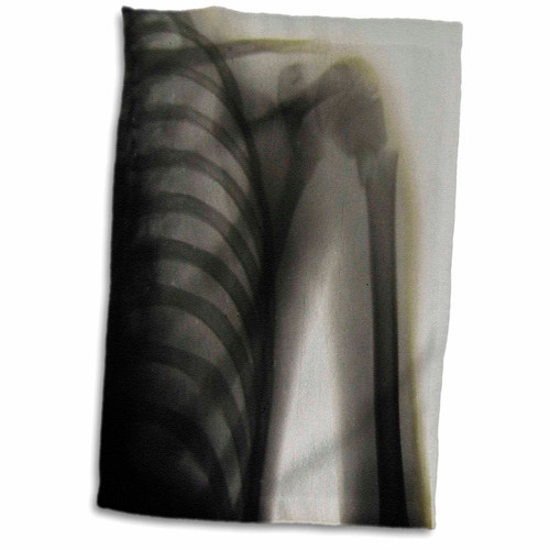 3dRose Scenes from the Past Magic Lantern - Vintage Xray of a Human Shoulder Magic Lantern Slide Medical 1890-12x18 Towel (twl_246409_1)