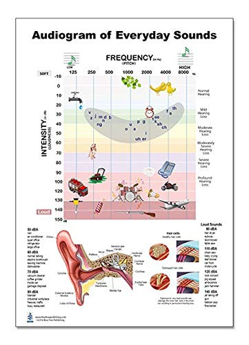 Blue Tree Publishing Audiogram of Everyday Sound Poster 12x17inch, Audiologist, Speech Banana, Waterproof, Show Frequency, Pitch and Ear Infomation