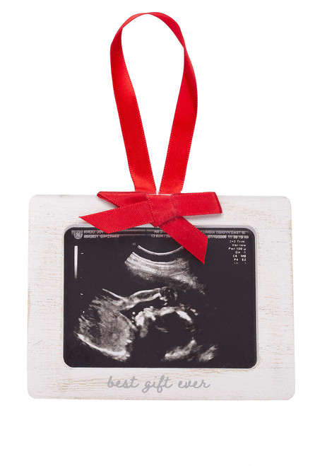 Pearhead Sonogram Picture Ornament, Baby Ornament, Gift for Expecting Parents, Ultrasound Photo Frame, Rustic Christmas Pearhead Sonogram Picture Ornament, Baby Ornament, Gift for Expecting Parents, Ultrasound Photo Frame, Rustic Christmas
