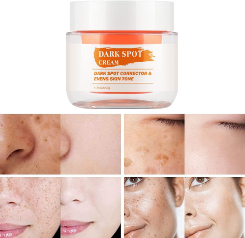 Dark Spot Remover Cream, Facial Cream for Dark Spot, Underarm Cream Brightening Cream, Dark Spot Remover for Face and Body, Age Spot Remover for Face, Dark Armpit Remover for Face, Neck -1.76 Oz