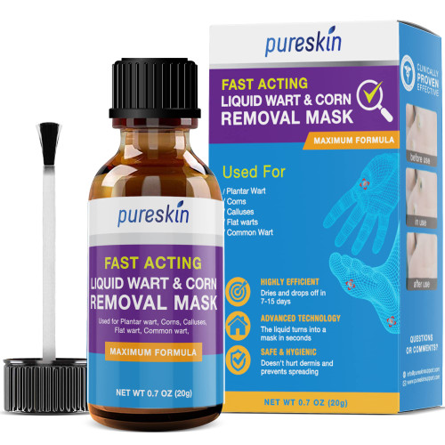 Pureskin Corn removers for feet Extra Strength, Foot Corn Remover, salicylic acid Corn wart Removal for Toes, Liquid Corn treatment and Callus Remover