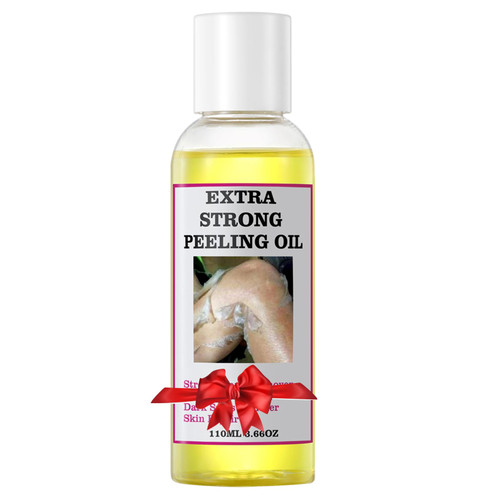 Peeling Oil for Dark Skin, Yellow Peeling Oil, Strong Peeling Oil Extra Strength, Exfoliating Peeling Solution for Body All Skin Type - 110ML/3.66 OZ
