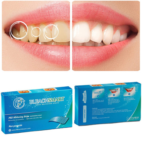 Teeth Whitening Strips Bleachsmart - 28 Strips, 7 Days Express Whitening Strips, Non-Peroxide, Professional Teeth Whitener Teeth Whitening Strips Bleachsmart - 28 Strips, 7 Days Express Whitening Strips, Non-Peroxide, Professional Teeth Whitener