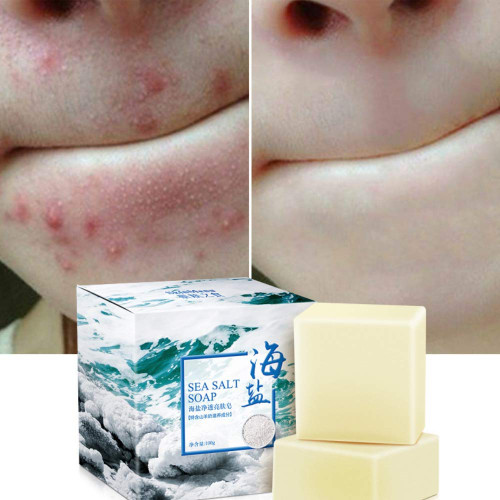 Reddhoon 2 Pack Handmade Sea Salt Soap Natural Goat Milk Soap for Dry and Natural Oily Skin, Remove Acne Pimple Face Body Wash Soap (Each 3.52 Oz)