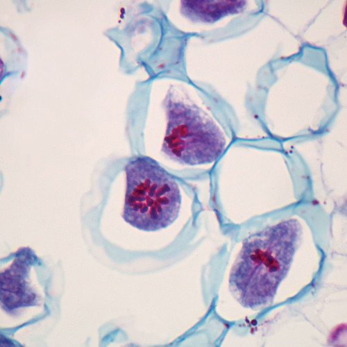 Lily Anther First Meiotic Division Slide, c.s., 12 m