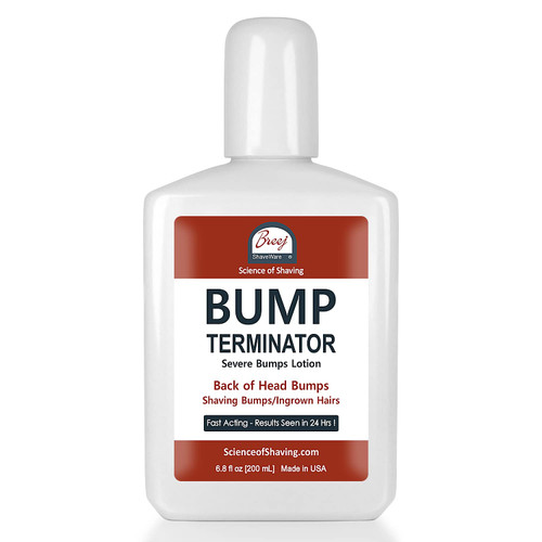 BUMP TERMINATOR Severe Bumps Treatment | Razor Bumps And Ingrown Hair Treatment | Razor Bump Treatment, 6.8 oz