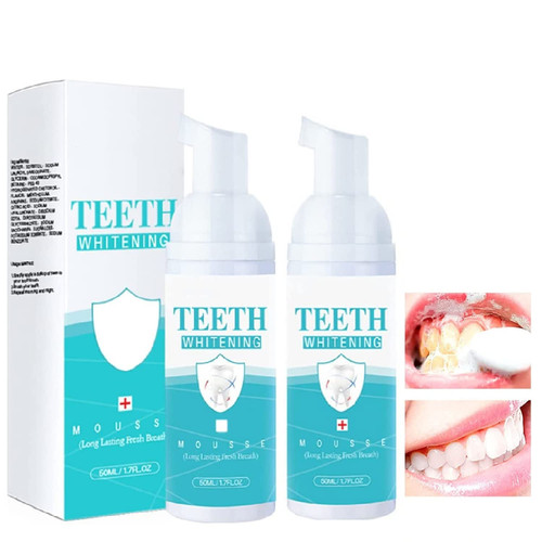 2Pcs Teeth Whitening Foam Toothpaste, Ultra-fine Mousse Foam Deeply Cleaning Gums,Stain Removal Easy to Use. 2Pcs Teeth Whitening Foam Toothpaste, Ultra-fine Mousse Foam Deeply Cleaning Gums,Stain Removal Easy to Use.