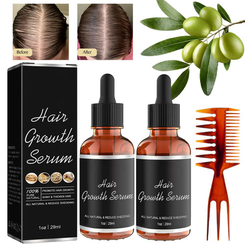 Noor Hair Growth Serum African Olives, Hair Growth Oil for Hair Loss, Noor Hair Growth Serum for White Black Women, Noor Love Hair Serum, Anti Hair Loss Nourishes Dry Damaged Hair (2) Noor Hair Growth Serum African Olives, Hair Growth Oil for Hair Loss, Noor Hair Growth Serum for White Black Women, Noor Love Hair Serum, Anti Hair Loss Nourishes Dry Damaged Hair (2)